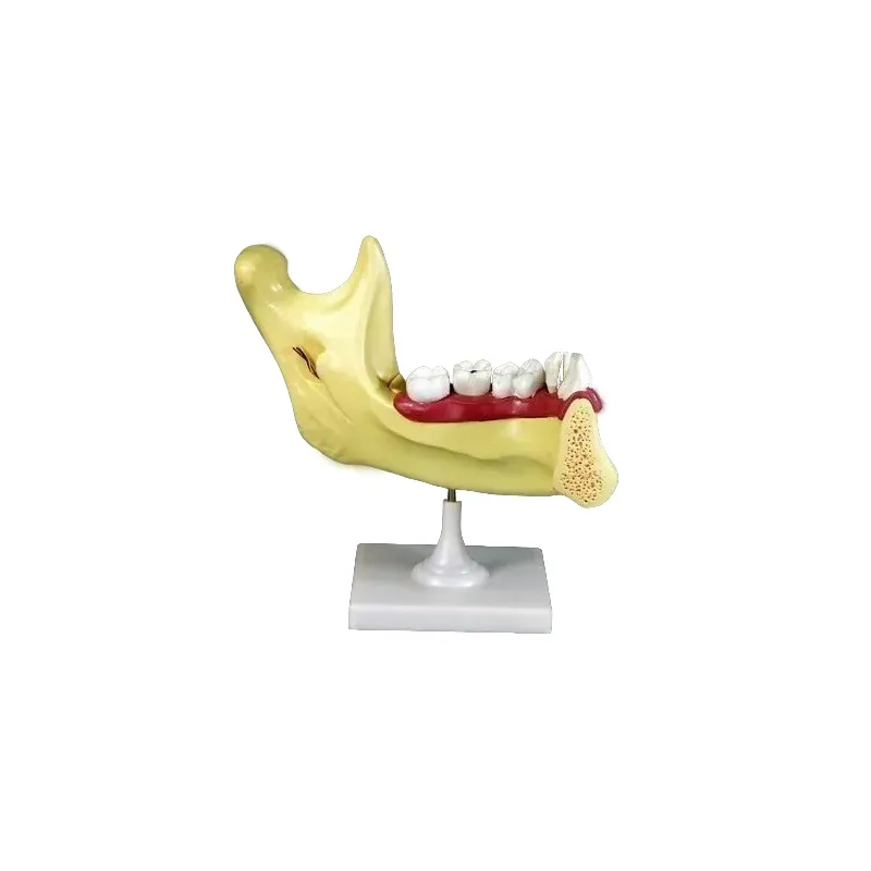 Модель «Челюсть» разборная