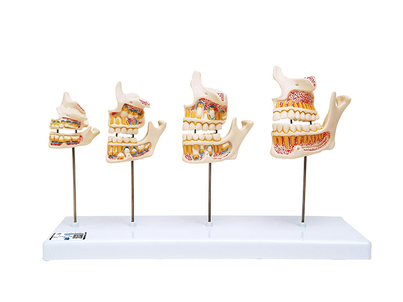 Модель развития зубов