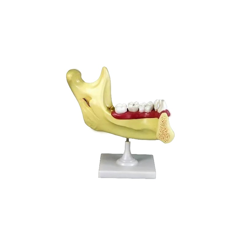 Модель «Челюсть» разборная