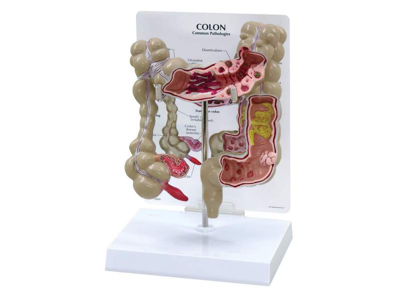 Модель толстой кишки