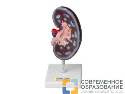 Модель почки в разрезе